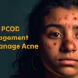 Woman with acne-prone skin