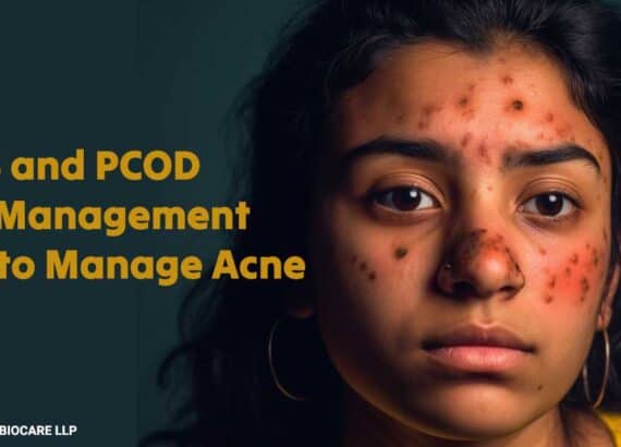 Woman with acne-prone skin