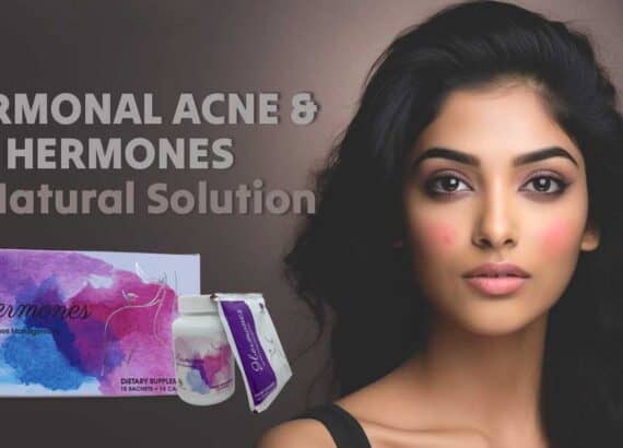 Hormonal Acne and Hermones : A Natural Solution